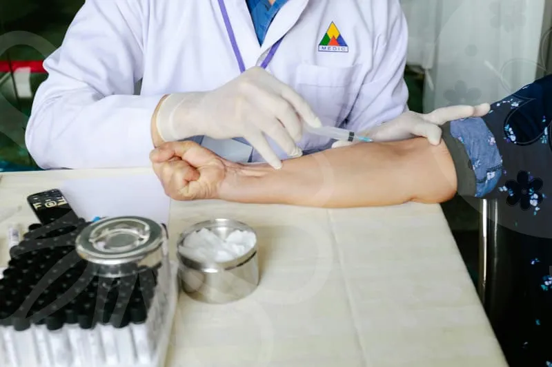 눈밑지방재배치