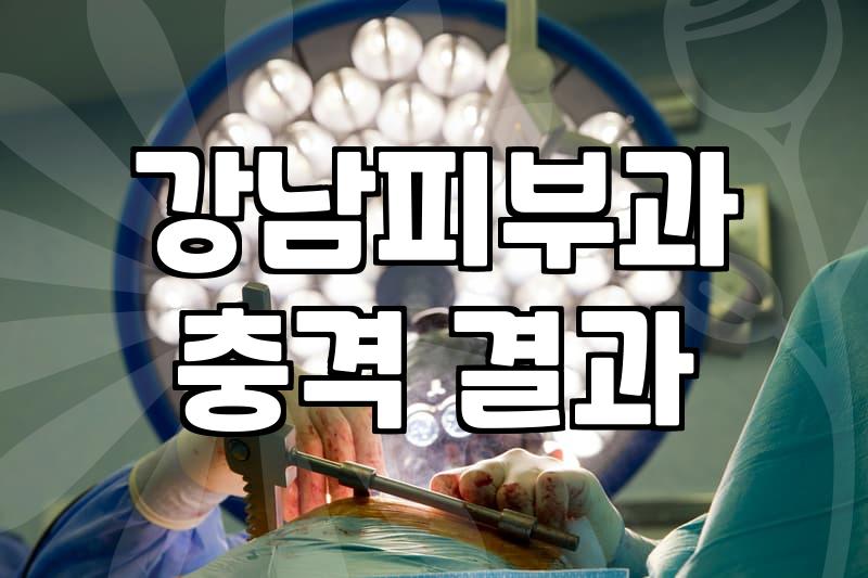 압구정로데오성형외과 선택 전 반드시 확인해야 할 5가지 체크포인트