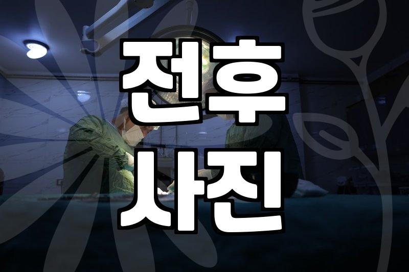 성형외과 실력, 홈페이지 후기만 믿어도 될까