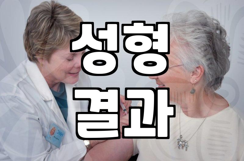 성형전후, 달라진 나의 모습 객관적으로 살펴보기